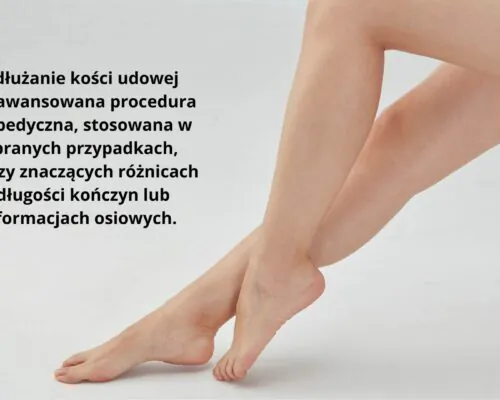 Wydłużanie kości udowej